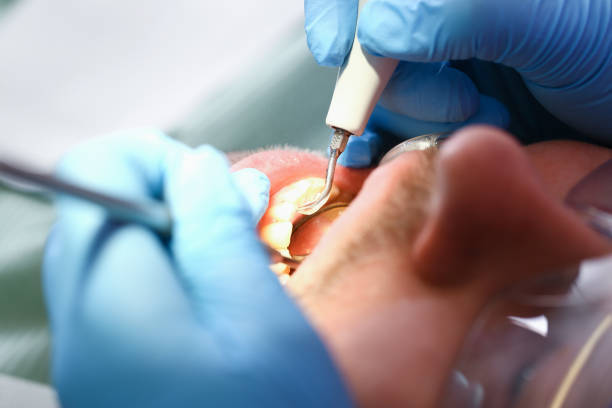 Best 24-Hour Emergency Dental Care in Griggsvle, IL
