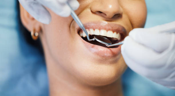 Best Emergency Care for Gum Disease in Griggsvle, IL