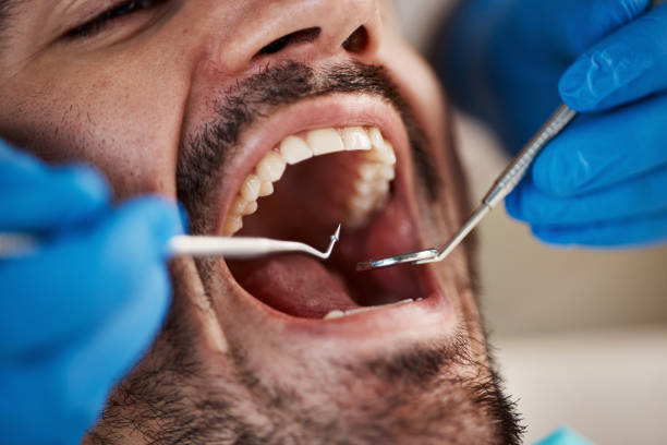 Best Emergency Dental Care for Sports Injuries in Griggsvle, IL