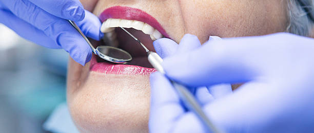 Best Emergency Denture Repair in Griggsvle, IL