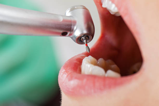 Best Emergency Cosmetic Dentistry (e.g., broken veneers) in Griggsvle, IL
